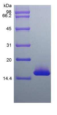 SDS-PAGE: Recombinant Mouse SF20/MYDGF Protein [NBP2-35172]