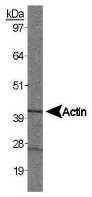 Western Blot: Mouse Kidney Whole Tissue Lysate (Adult Whole Normal) [NB820-59661]