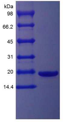 SDS-PAGE: Recombinant Mouse LIF Protein [NBP2-35153]