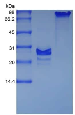 SDS-PAGE: Recombinant Mouse Noggin Protein [NBP2-35098]