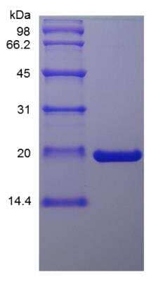 SDS-PAGE: Recombinant Mouse Oncostatin M/OSM Protein [NBP2-35112]