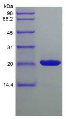 SDS-PAGE: Recombinant Mouse Sonic Hedgehog/Shh Protein [NBP2-35174]