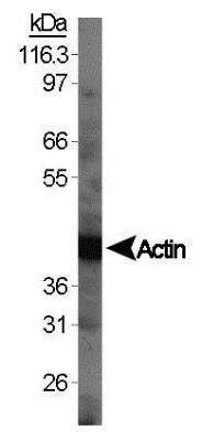 Western Blot: Mouse Spleen Whole Tissue Lysate (Adult Whole Normal) [NB820-59670]