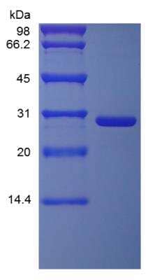 SDS-PAGE: Recombinant Mouse TNF RII/TNFRSF1B Protein [NBP2-35182]