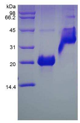 SDS-PAGE: Recombinant Mouse VEGF 164 Protein [NBP2-35189]
