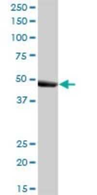 Western Blot: Ig gamma-3 Chain C Region Antibody [H00003502-B01P]