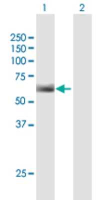 Western Blot: Ig gamma-3 Chain C Region Antibody [H00003502-B01P]