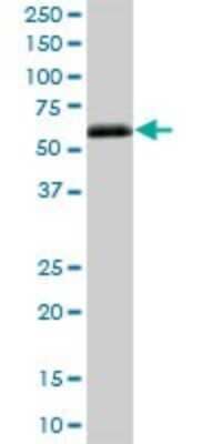 Western Blot: Ig gamma-4 Chain C Region Antibody [H00003503-B01P]