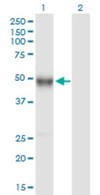 Western Blot: Ig gamma-4 Chain C Region Antibody [H00003503-B01P]