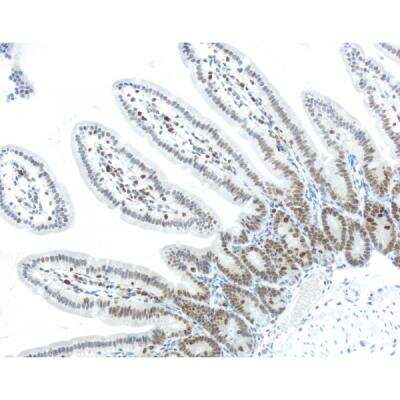 Immunohistochemistry: M.O.M.(R) (Mouse-On-Mouse) ImmPRESS(R) IgG HRP polymer Immunodetection Kit [MP-2400-NB]