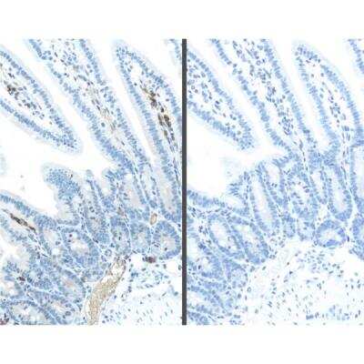 Immunohistochemistry: M.O.M.(R) (Mouse-On-Mouse) ImmPRESS(R) IgG HRP polymer Immunodetection Kit [MP-2400-NB]