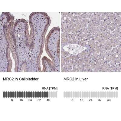 Immunohistochemistry-Paraffin: Mrc2 Antibody [NBP1-85768]