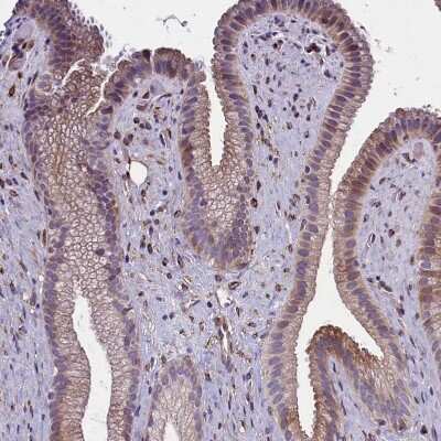 Immunohistochemistry-Paraffin: Mrc2 Antibody [NBP1-85768]