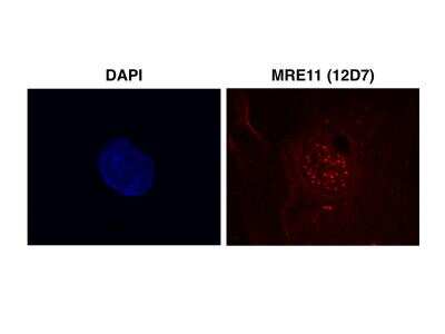 Immunocytochemistry/ Immunofluorescence: Mre11 Antibody (12D7) [NB100-473]