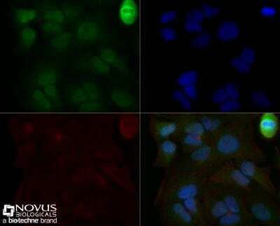 Immunocytochemistry/ Immunofluorescence: Mre11 Antibody (15B8.1E7.6) - BSA Free [NBP2-59677]