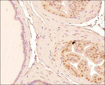 Immunohistochemistry-Paraffin: Mre11 Antibody (15B8.1E7.6) - BSA Free [NBP2-59677]