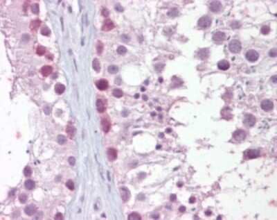 Immunohistochemistry-Paraffin: Mre11 Antibody [NB100-56339]