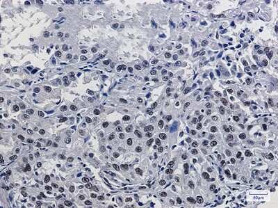 Immunohistochemistry-Paraffin: Mre11 Antibody (S03-6H9) [NBP3-15115]