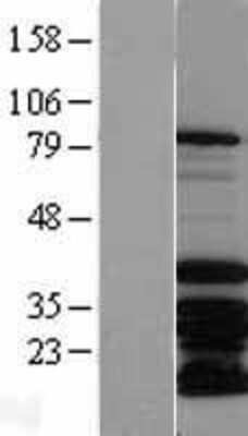 Western Blot: MSX2 Overexpression Lysate [NBP2-04226]