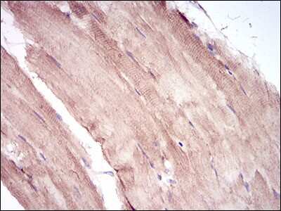 Immunohistochemistry-Paraffin: MuRF1/TRIM63 Antibody (6H6D4) - BSA Free [NBP2-52515]