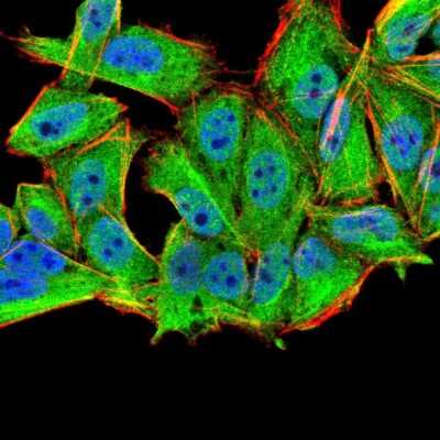 Immunocytochemistry/ Immunofluorescence: MuRF1/TRIM63 Antibody (7B8E1) - BSA Free [NBP2-52516]