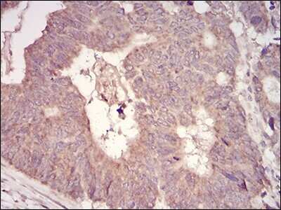 Immunohistochemistry: MuRF1/TRIM63 Antibody (7B8E1) - BSA Free [NBP2-52516]