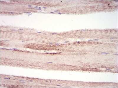 Immunohistochemistry-Paraffin: MuRF1/TRIM63 Antibody (7B8E1) - BSA Free [NBP2-52516]