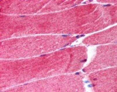 Immunohistochemistry-Paraffin: MuRF1/TRIM63 Antibody [NB100-1193]