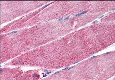 Immunohistochemistry-Paraffin: MuRF1/TRIM63 Antibody [NB100-2406]