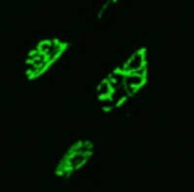 Immunocytochemistry/ Immunofluorescence: MuSK Antibody (10A4) - BSA Free [NBP1-47441]