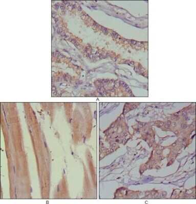 Immunohistochemistry-Paraffin: MuSK Antibody (10A4) - BSA Free [NBP1-47441]