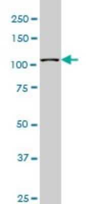 Western Blot: MuSK Antibody (1F3) [H00004593-M01]