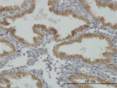 Immunohistochemistry-Paraffin: MuSK Antibody (2H6) [H00004593-M07]