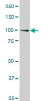 Western Blot: MuSK Antibody (2H6) [H00004593-M07]