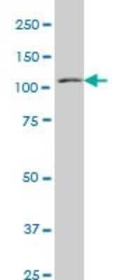 Western Blot: MuSK Antibody (4C12) [H00004593-M03]