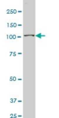 Western Blot: MuSK Antibody (4E5) [H00004593-M02]