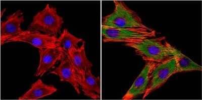 Immunocytochemistry/ Immunofluorescence: MuSK Antibody [NB120-5619]
