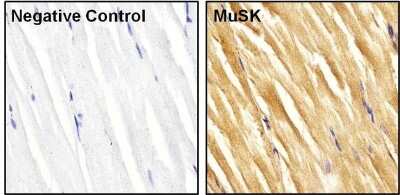 Immunohistochemistry-Paraffin: MuSK Antibody [NB120-5619]