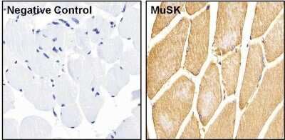 Immunohistochemistry-Paraffin: MuSK Antibody [NB120-5619]