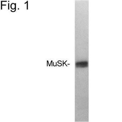 Western Blot: MuSK Antibody [NB120-5619]