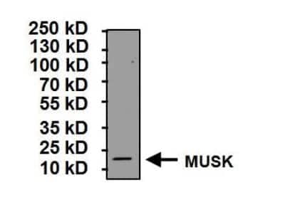 Western Blot: MuSK Antibody [NB120-5619]