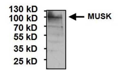 Western Blot: MuSK Antibody [NB120-5619]