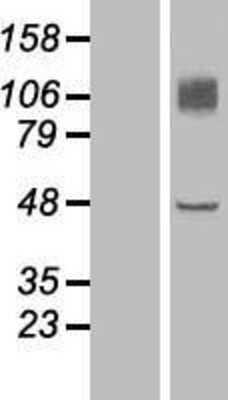 Western Blot: Endomucin/Mucin -14 Overexpression Lysate [NBP2-07067]