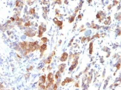 Immunohistochemistry-Paraffin: MUC5AC Antibody (MUC5AC/917) - Azide and BSA Free [NBP2-54448]