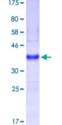 SDS-PAGE: Recombinant Human MUC5B GST (N-Term) Protein [H00727897-Q01]