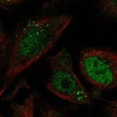 Immunocytochemistry/ Immunofluorescence: Mucolipin 1 Antibody [NBP3-17197]