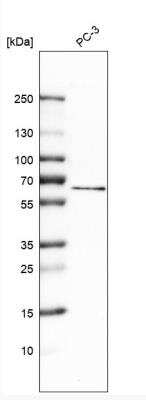 Western Blot: Mucolipin 1 Antibody [NBP1-92152]