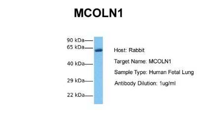 Western Blot: Mucolipin 1 Antibody [NBP2-87859]