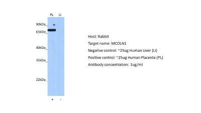 Western Blot: Mucolipin 1 Antibody [NBP2-87859]