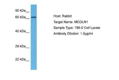 Western Blot: Mucolipin 1 Antibody [NBP2-87859]